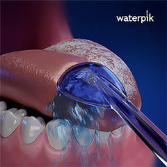 Waterpik™ Classic Water Flosser Tongue Cleaner
