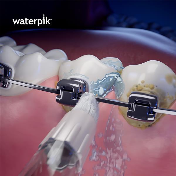 Waterpik™ Whitening Water Flosser - Orthodontic Tip